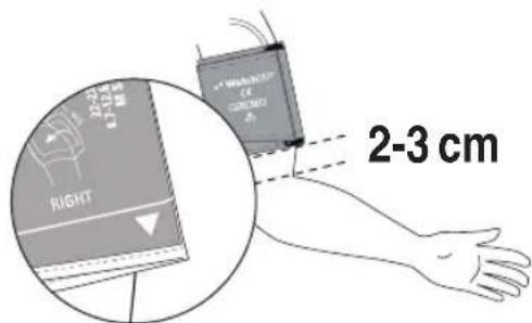 MICROLIFE WatchBP O3 A - Mesure de la pression arterielle en mode «AMBULATORY » - 3