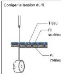BROTHER PQ1500SL - Tension des fils - 1