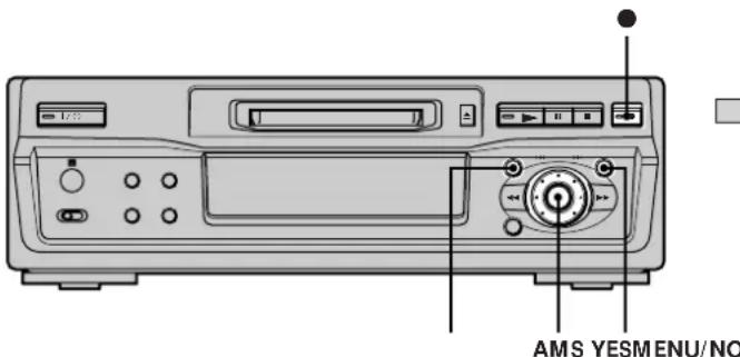 SONY MDSS40 - Inscription de numéros de   plage pendant   l'enregistrement (Track Marking) - 1
