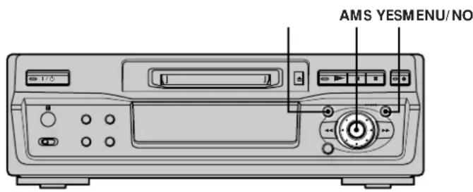 SONY MDSS40 - Pour annuler l'opération - 1