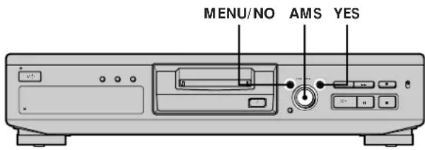 SONY MDSJE330 - Conseils pour l'enregistrement à partir de MD sur une cassette - 1