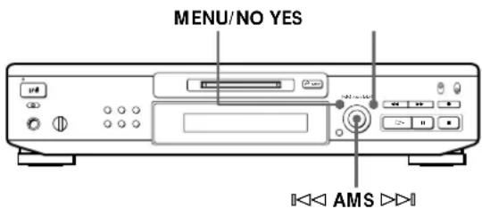 SONY MDSJE520 - Undoing the Last Edit (Undo Function) - 1