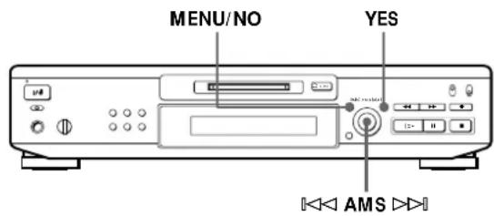 SONY MDSJE520 - Erasing Recordings (Erase Function) - 1