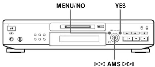 SONY MDSJE520 - Cancelación de laULTima edition (Función de cancelación) - 1