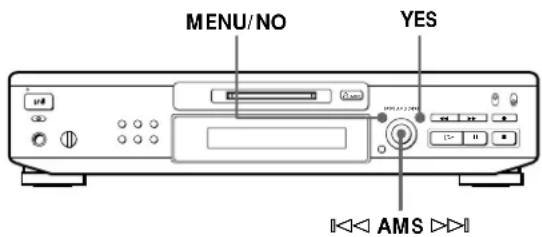 SONY MDSJE520 - Apagamento de gravações (função de apagamento) - 1