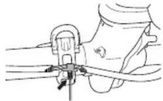 HUSQVARNA 545FR - Gaszugschmierung - 2