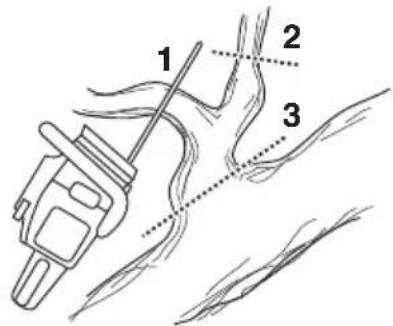 HUSQVARNA 439 - Snoeien - 1