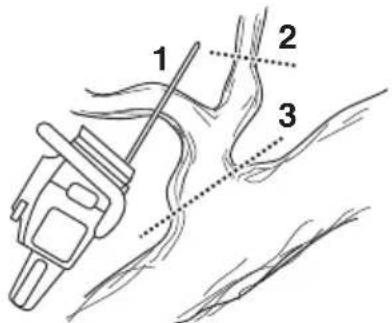 HUSQVARNA 439 - Desramado - 1
