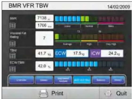 TANITA MC980MA - Analyse par segmentation - 2
