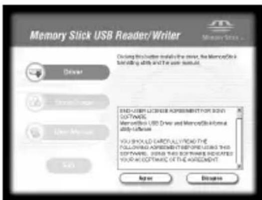 SONY MSACUS30 - Lue Lisensssisopimus (License Agreement) huolellisesti ja napsauta sitten [Agree] -painiketta. - 1