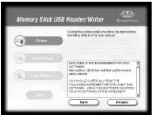 SONY MSACUS30 - 仔細閱讀軟體授權合約，然後按一下[Agree]按鈕。 - 1