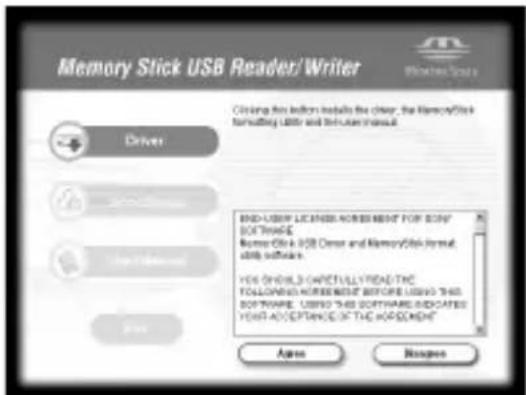 SONY MSACUS30 - Leggere attendamente il License Agreement, poi fareblick sul pulsante [Agree]. - 1