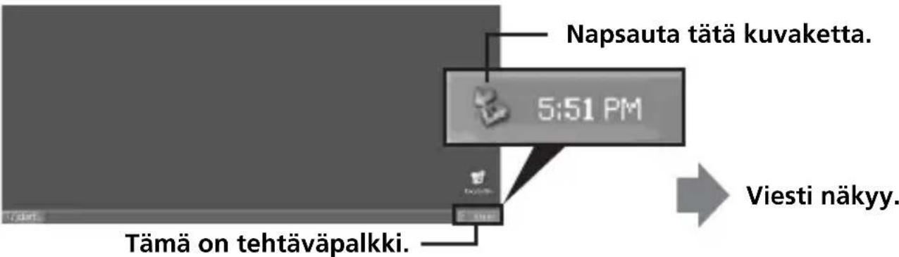 SONY MSACUS30 - Laitteen irrottaminen tietokoneesta - 1