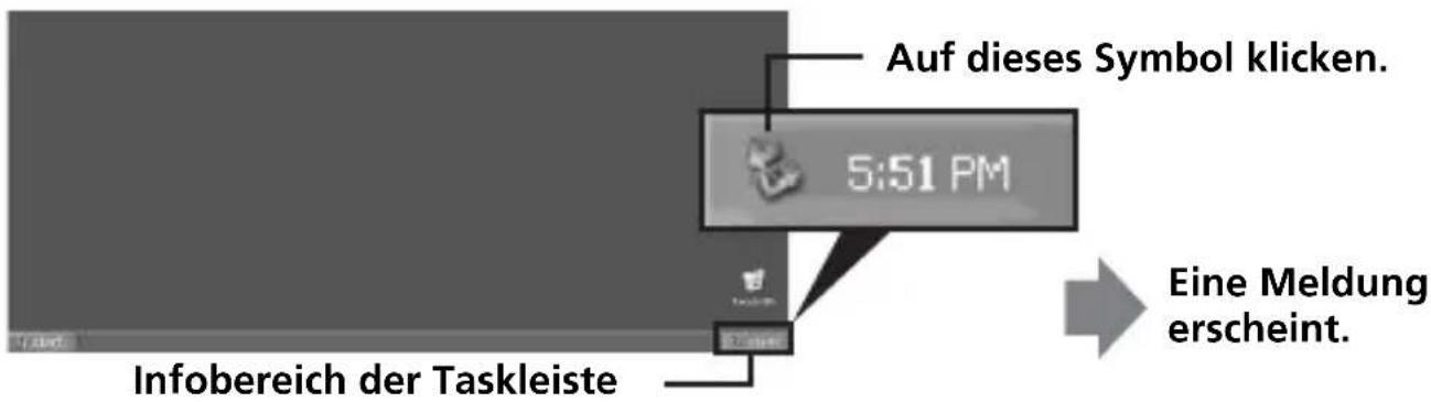 SONY MSACUS30 - Abtrennen des Geräts vom Computer - 1