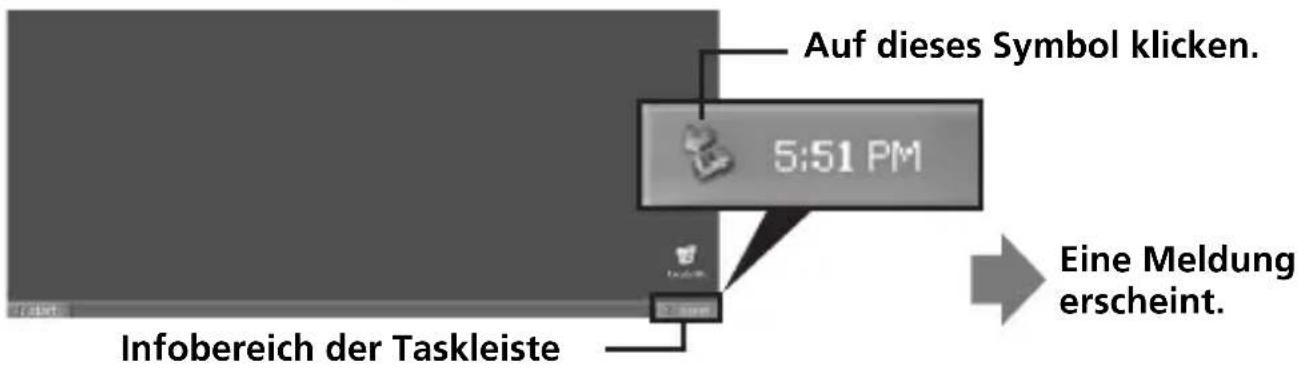 SONY MSACUS40 - Abtrennen des Geräts vom Computer - 1