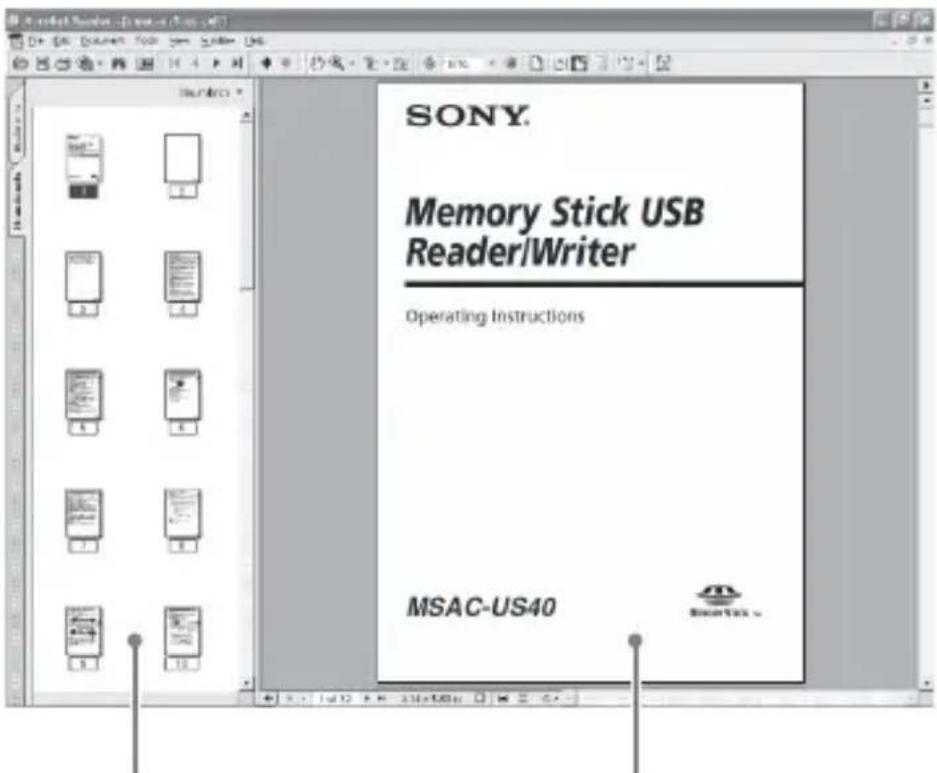 SONY MSACUS40 - Изобрахенье на заразе - 1
