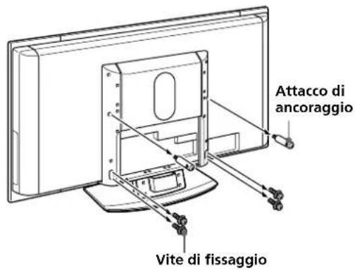 SONY SUPF3L - Rimuovere il televisore dal supporto da tavolo. - 1