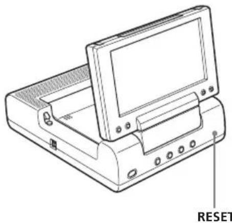 SONY MV650STR - Ripristino del lettore - 1