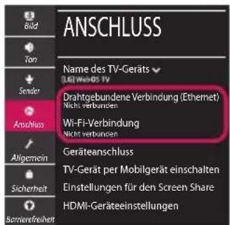 LG 49UM71007LB - Netzwerkeinstellungen - 2