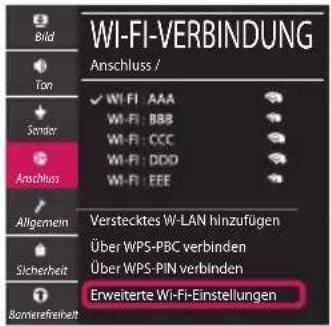 LG 49UM71007LB - Netzwerkeinstellungen - 5