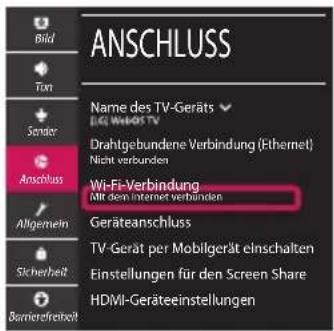 LG 49UM71007LB - Netzwerkeinstellungen - 4