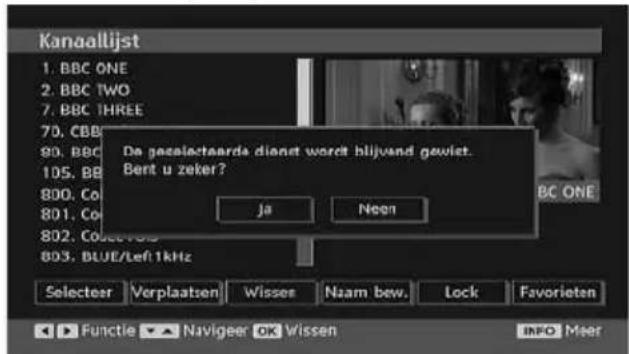 MEDION LIFE P14010 (MD 30314) - De zenders verwijderen uit de zenderlijkst - 2