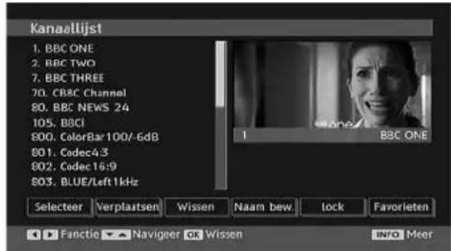 MEDION LIFE P14010 (MD 30314) - De zenders verwijderen uit de zenderlijkst - 1