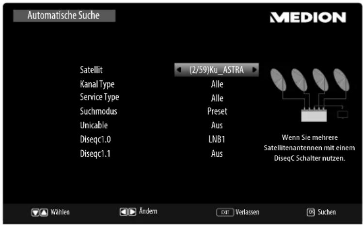 MEDION LIFE P18107 (MD 31161) - Satellite - 1