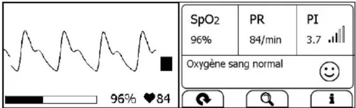 THOMSON CheckMe Pro - Mesurer sans câble - 2