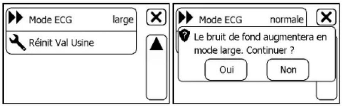 THOMSON CheckMe Pro - Réglage de la bande passante d'ECG - 1