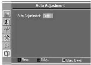 VOXX FPE1505 - Adjusting Clock and Phase - 2