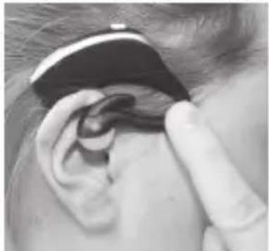 BEURER SL 70 - Attaching the snore stopper - 1