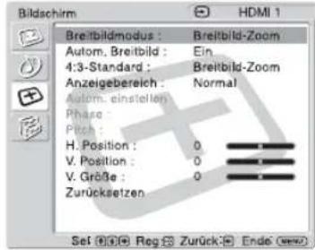 SONY KLHW26 - Bildschirm - 1
