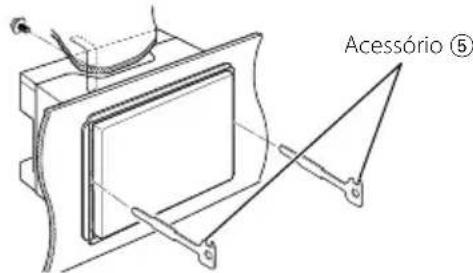 KENWOOD DNX8022BT - Remova aunities - 1