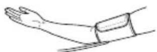 OMRON CS2 - Applicazione del bracciale - 1