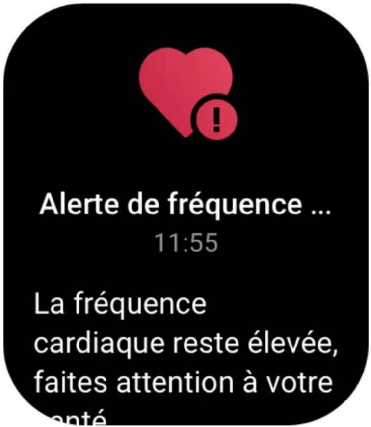AMAZFIT GTS 3 - Alertes de fréquence cardiaque - 1