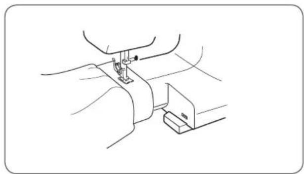 Bernette b33 - Coffret d'accessoires - 1