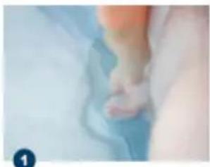 Exit Toys Classic spa - Kit de réparation - 1