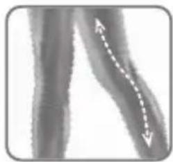 ROWENTA Derma Perfect EP9830 - - Areas of the body - 2