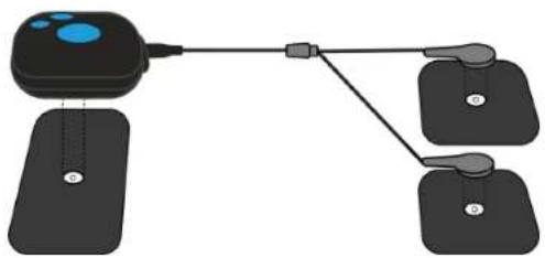 BLUETENS Duo Sport 2 - CONNECTER LES ÉLECTRODES - 1