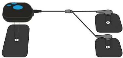 BLUETENS Duo Sport 2 - CONNECTING THE ELECTRODES - 1