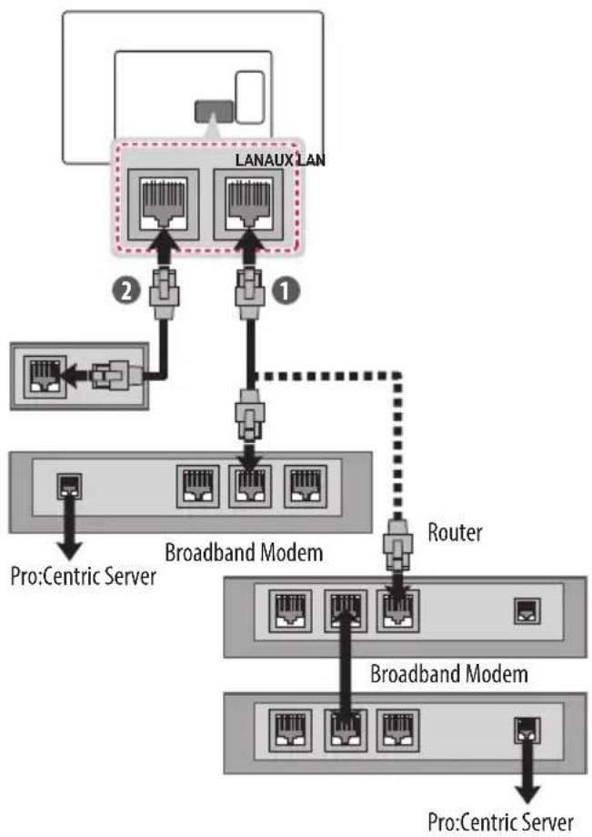 LG 55UX960H - Wired network connection - 1