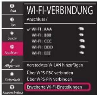 LG 55UM71007LB - Netzwerkeinstellungen - 5