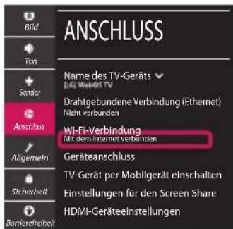 LG 55UM71007LB - Netzwerkeinstellungen - 4