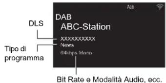 ONKYO CSN575 - Visualizzazioni informazioni DAB Radio - 1