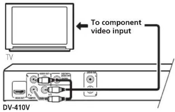 PIONEER DV310 - Connecting using the component video output - 1