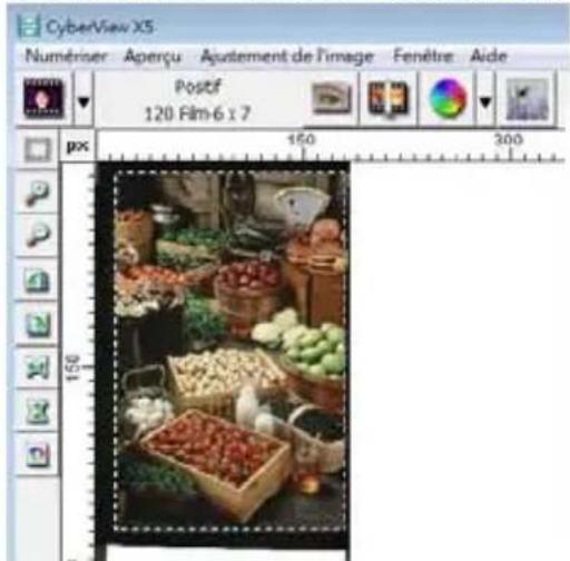 BRAUN CyberView X5 - ETAPE 3 - Pré-scan optionnel - 2