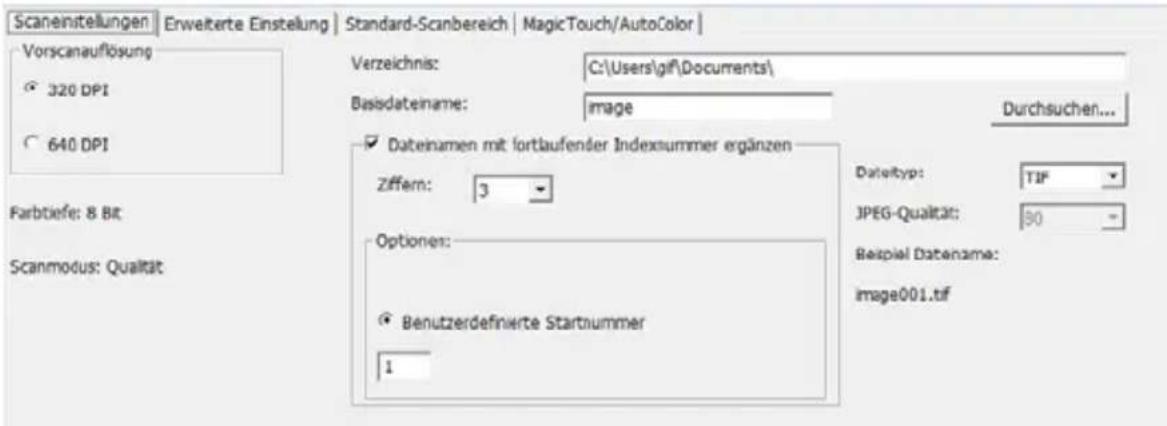 BRAUN CyberView X5 - Schnitt 4 - Set Scan Settings (Scaneinstellungen festlegen) - 1