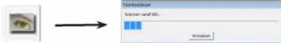 BRAUN CyberView X5 - STAP 3 - Optionele Voorbeeldscan - 1