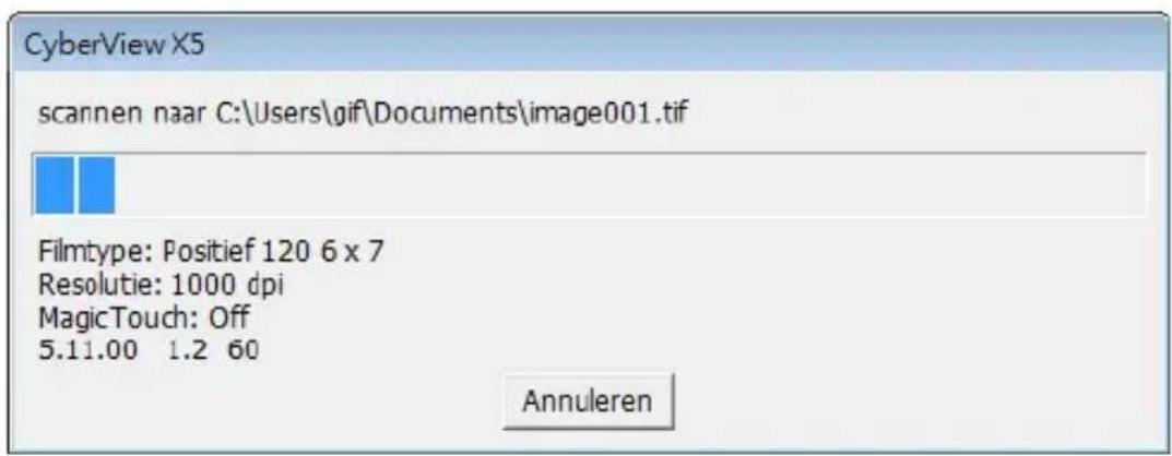 BRAUN CyberView X5 - Scannen (ervolg...) - 1